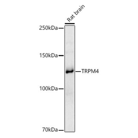 Western Blot - Anti-TRPM4 Antibody (A8537) - Antibodies.com