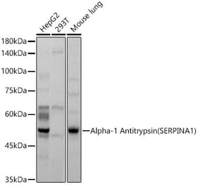 Western Blot - Anti-alpha 1 Antitrypsin Antibody (A8538) - Antibodies.com