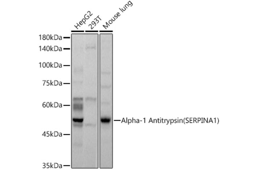 Western Blot - Anti-alpha 1 Antitrypsin Antibody (A8538) - Antibodies.com