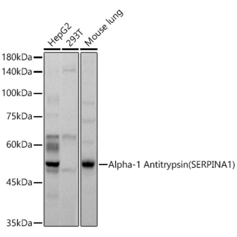 Western Blot - Anti-alpha 1 Antitrypsin Antibody (A8538) - Antibodies.com