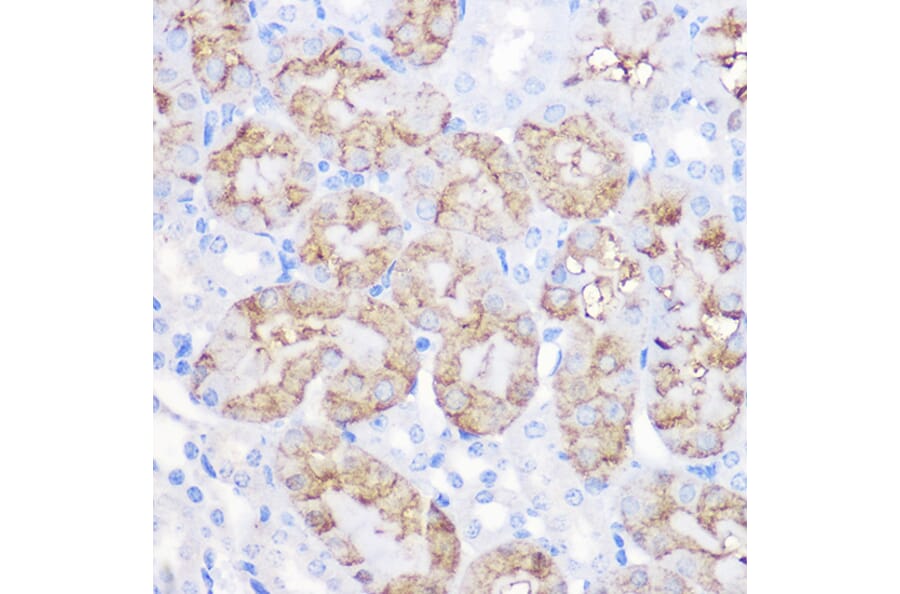 Immunohistochemistry - Anti-alpha 1 Antitrypsin Antibody (A8538) - Antibodies.com