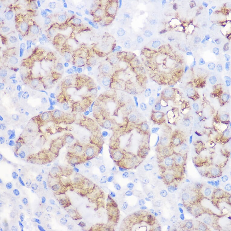 Immunohistochemistry - Anti-alpha 1 Antitrypsin Antibody (A8538) - Antibodies.com