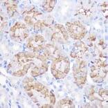 Immunohistochemistry - Anti-alpha 1 Antitrypsin Antibody (A8538) - Antibodies.com