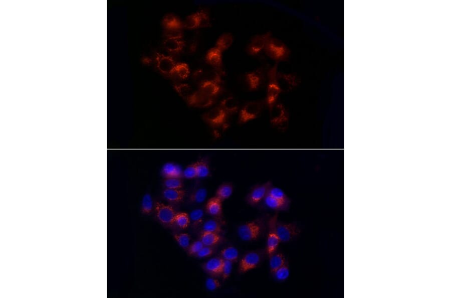 Immunofluorescence - Anti-alpha 1 Antitrypsin Antibody (A8538) - Antibodies.com