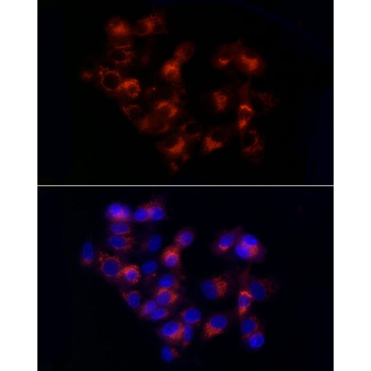 Immunofluorescence - Anti-alpha 1 Antitrypsin Antibody (A8538) - Antibodies.com