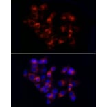 Immunofluorescence - Anti-alpha 1 Antitrypsin Antibody (A8538) - Antibodies.com