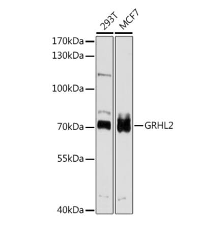 Western Blot - Anti-GRHL2 Antibody (A8539) - Antibodies.com