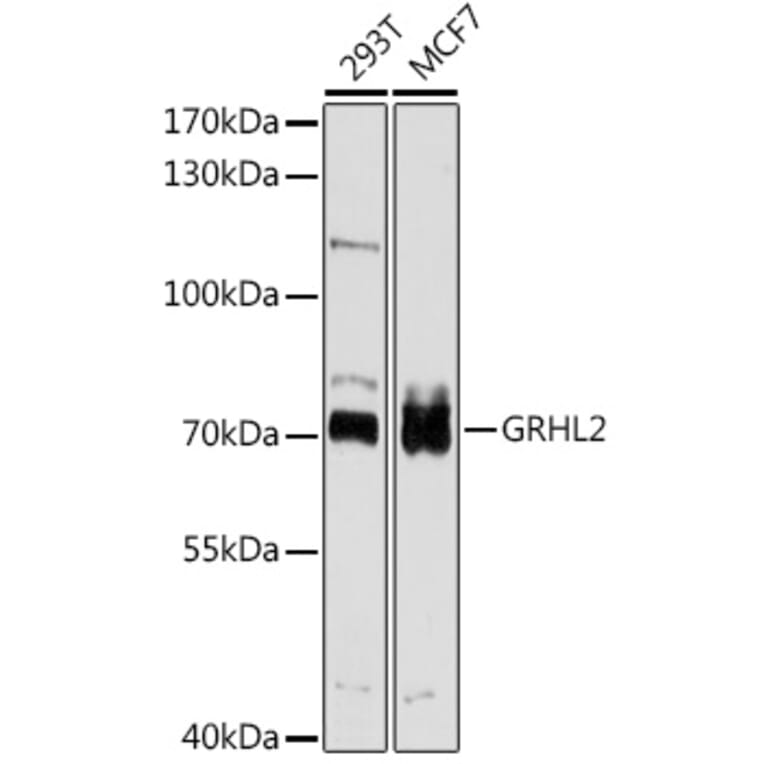 Western Blot - Anti-GRHL2 Antibody (A8539) - Antibodies.com