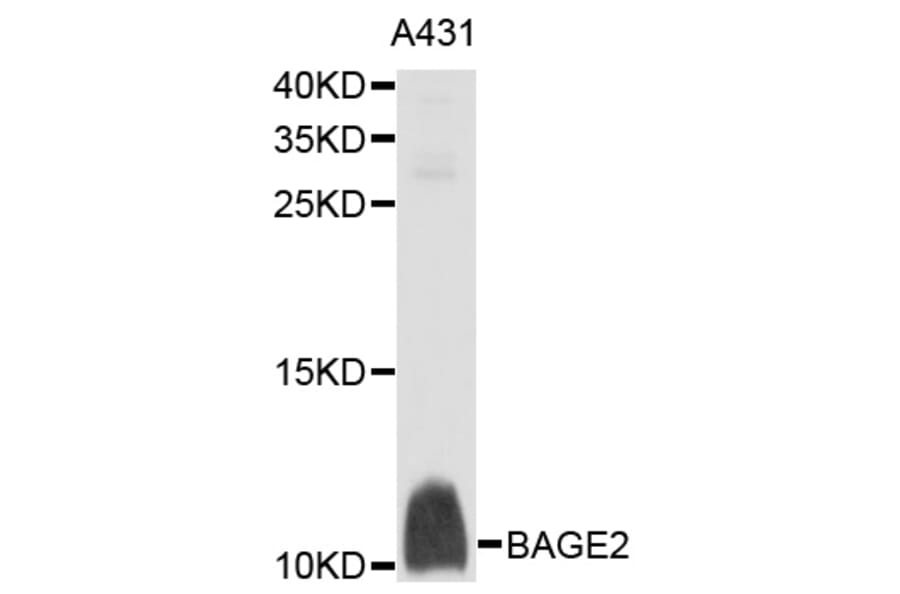 Western Blot - Anti-BAGE2 Antibody (A10159) - Antibodies.com