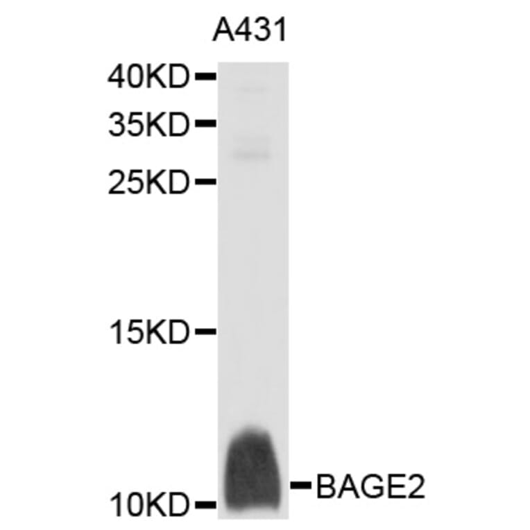 Western Blot - Anti-BAGE2 Antibody (A10159) - Antibodies.com