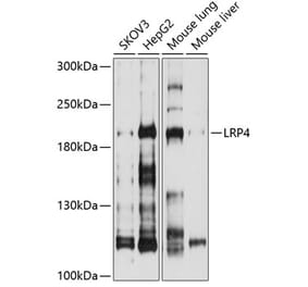 Western Blot - Anti-LRP4 Antibody (A8542) - Antibodies.com