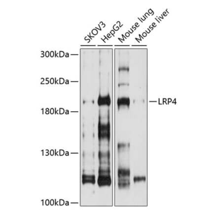 Western Blot - Anti-LRP4 Antibody (A8542) - Antibodies.com