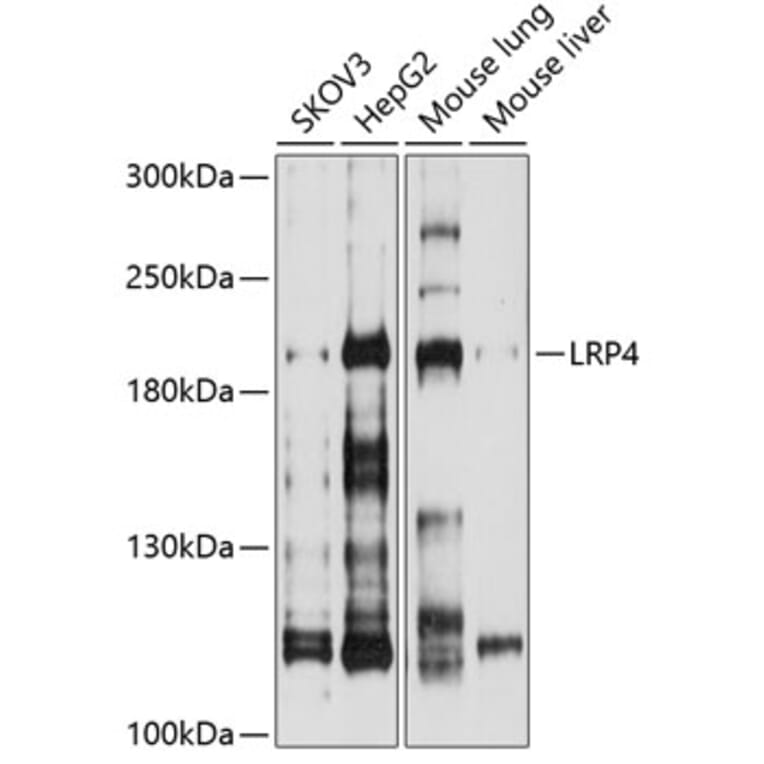 Western Blot - Anti-LRP4 Antibody (A8542) - Antibodies.com