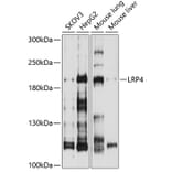 Western Blot - Anti-LRP4 Antibody (A8542) - Antibodies.com