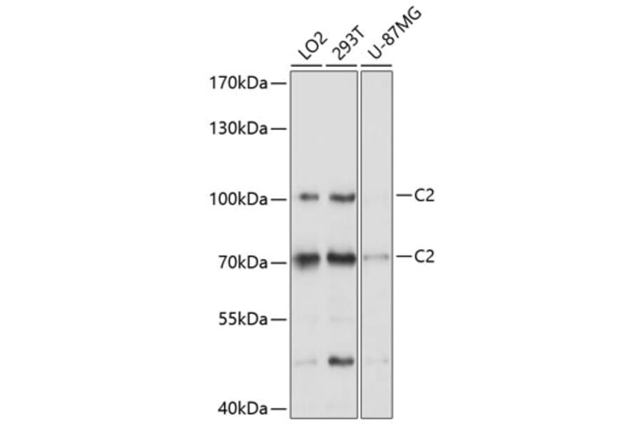 Western Blot - Anti-C2 Antibody (A8546) - Antibodies.com
