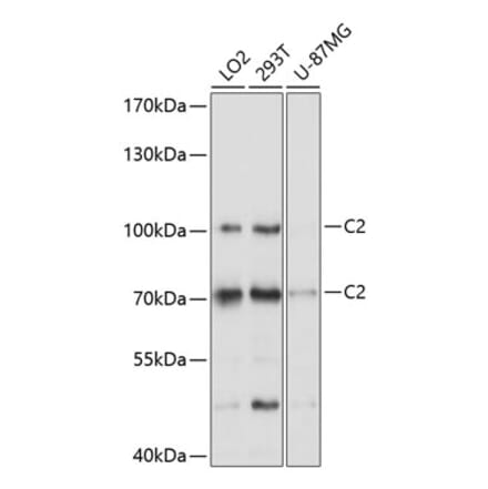 Western Blot - Anti-C2 Antibody (A8546) - Antibodies.com