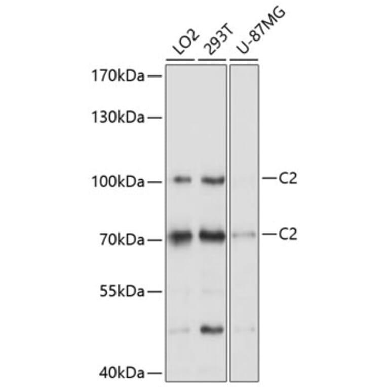 Western Blot - Anti-C2 Antibody (A8546) - Antibodies.com