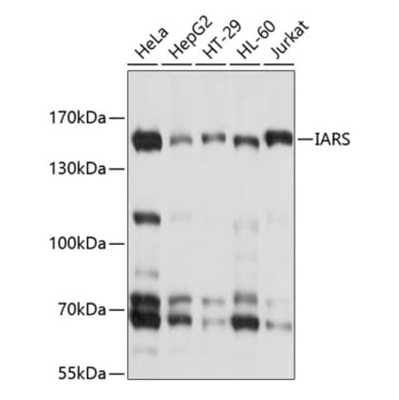 Western Blot - Anti-Isoleucyl tRNA synthetase Antibody (A8547) - Antibodies.com