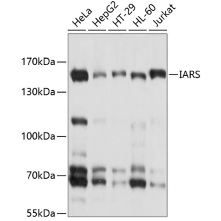 Western Blot - Anti-Isoleucyl tRNA synthetase Antibody (A8547) - Antibodies.com