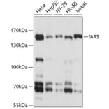 Western Blot - Anti-Isoleucyl tRNA synthetase Antibody (A8547) - Antibodies.com