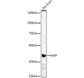 Western Blot - Anti-FKRP Antibody (A8549) - Antibodies.com