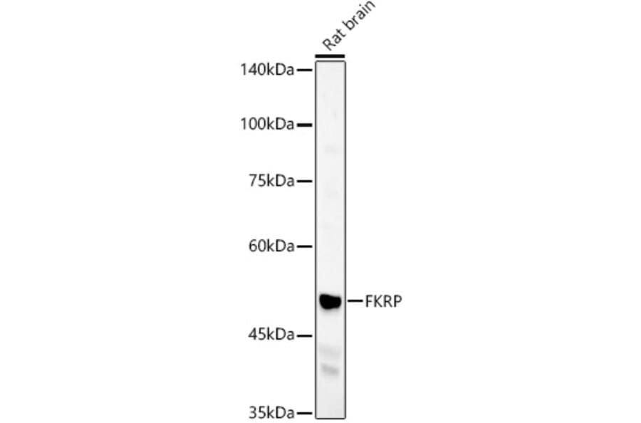 Western Blot - Anti-FKRP Antibody (A8549) - Antibodies.com