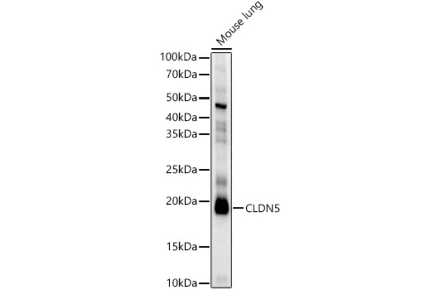 Western Blot - Anti-Claudin 5 Antibody (A8552) - Antibodies.com