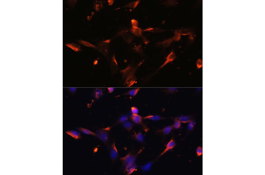 Immunofluorescence - Anti-Claudin 5 Antibody (A8552) - Antibodies.com