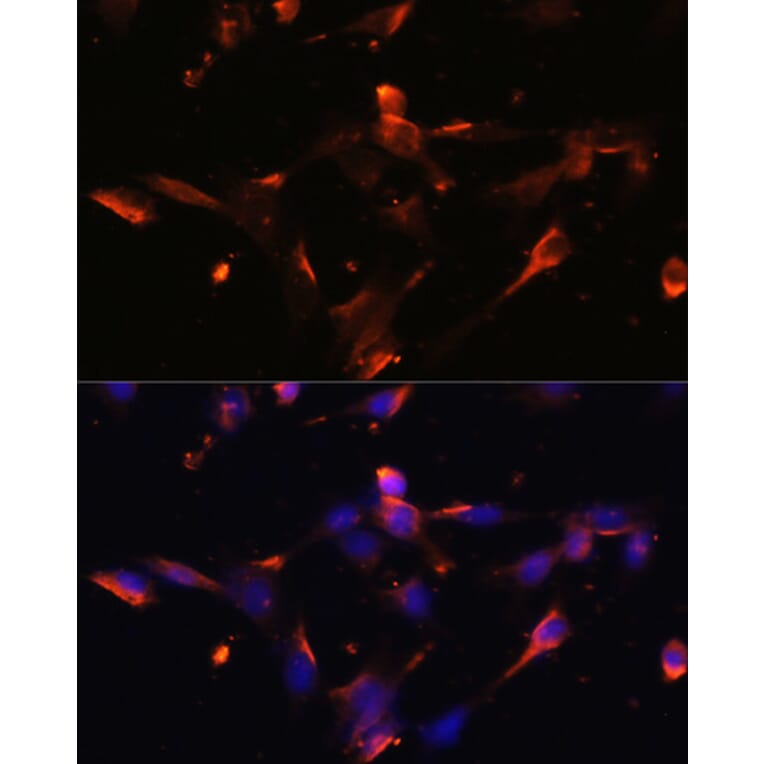 Immunofluorescence - Anti-Claudin 5 Antibody (A8552) - Antibodies.com
