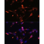 Immunofluorescence - Anti-Claudin 5 Antibody (A8552) - Antibodies.com