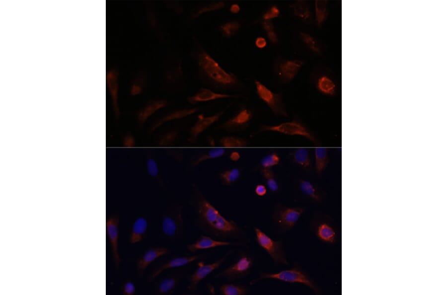 Immunofluorescence - Anti-Claudin 5 Antibody (A8552) - Antibodies.com
