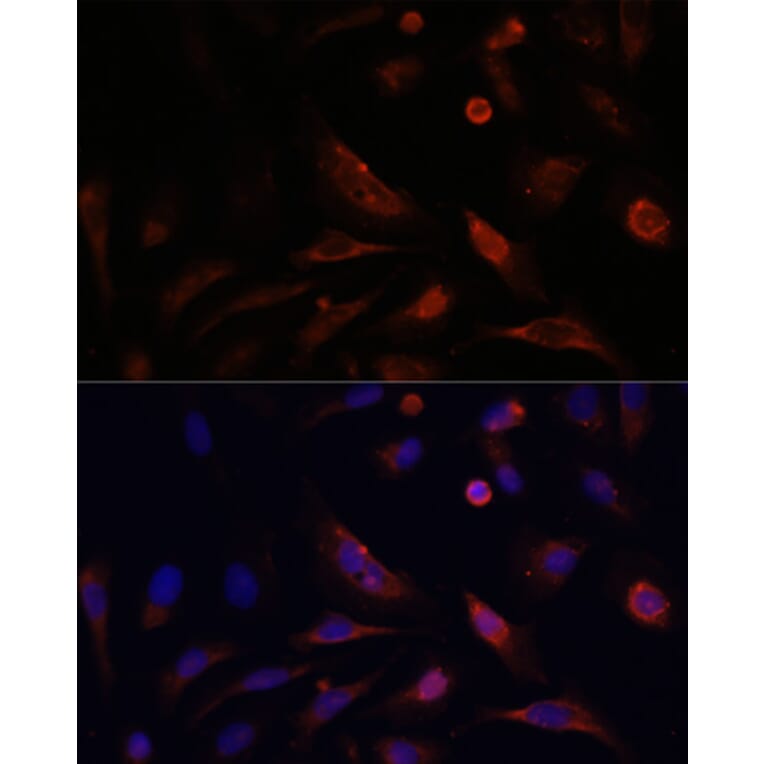 Immunofluorescence - Anti-Claudin 5 Antibody (A8552) - Antibodies.com