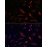 Immunofluorescence - Anti-Claudin 5 Antibody (A8552) - Antibodies.com