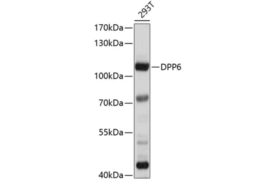 Western Blot - Anti-DPP6 Antibody (A8553) - Antibodies.com