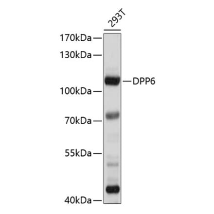 Western Blot - Anti-DPP6 Antibody (A8553) - Antibodies.com