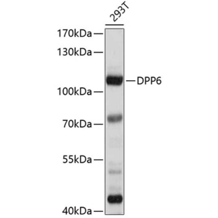 Western Blot - Anti-DPP6 Antibody (A8553) - Antibodies.com