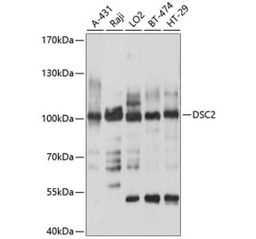 Western Blot - Anti-Desmocollin 2 Antibody (A8554) - Antibodies.com