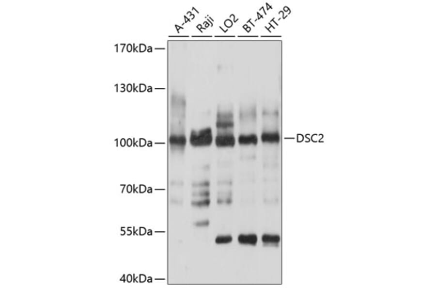 Western Blot - Anti-Desmocollin 2 Antibody (A8554) - Antibodies.com