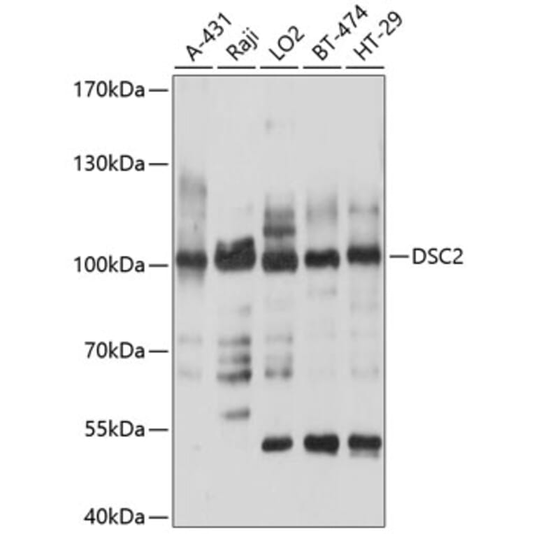 Western Blot - Anti-Desmocollin 2 Antibody (A8554) - Antibodies.com