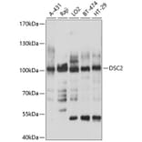 Western Blot - Anti-Desmocollin 2 Antibody (A8554) - Antibodies.com