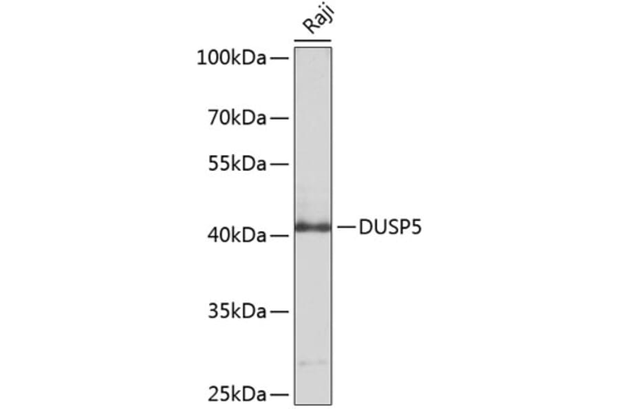Western Blot - Anti-DUSP5 Antibody (A8555) - Antibodies.com