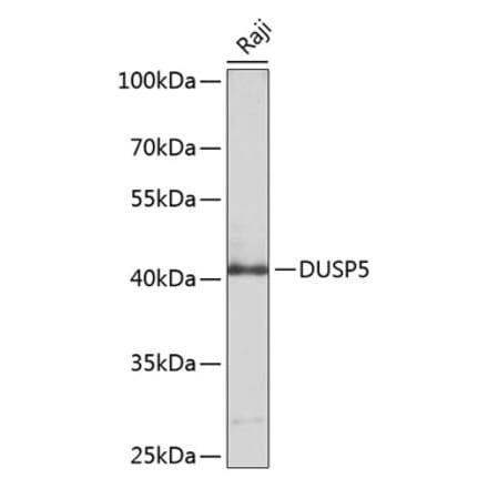 Western Blot - Anti-DUSP5 Antibody (A8555) - Antibodies.com