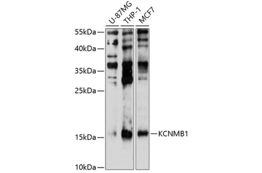 Western Blot - Anti-MaxiPotassiumchannelbeta/KCNMB1 Antibody (A8557) - Antibodies.com