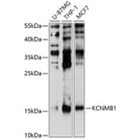 Western Blot - Anti-MaxiPotassiumchannelbeta/KCNMB1 Antibody (A8557) - Antibodies.com