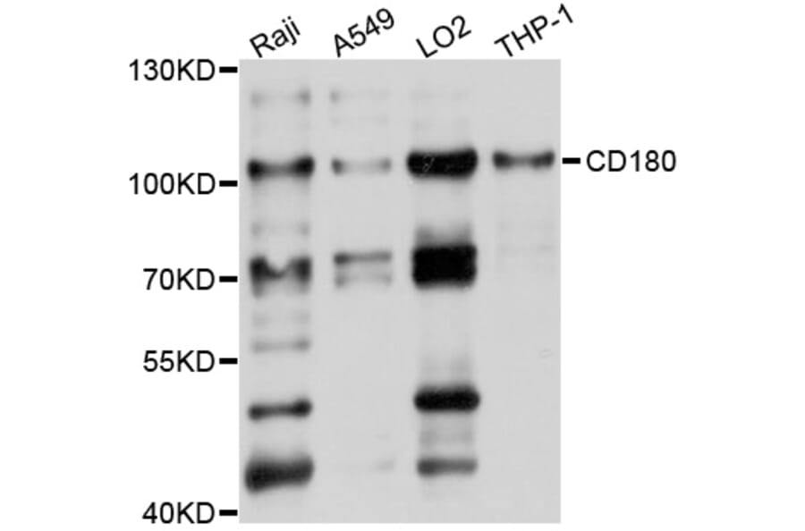 Western Blot - Anti-CD180 Antibody (A10226) - Antibodies.com