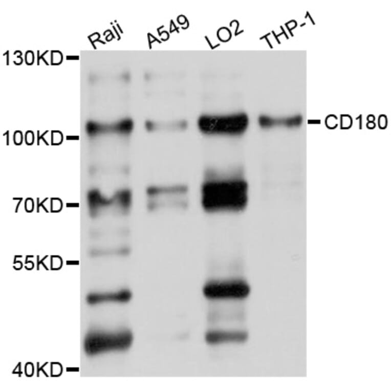 Western Blot - Anti-CD180 Antibody (A10226) - Antibodies.com