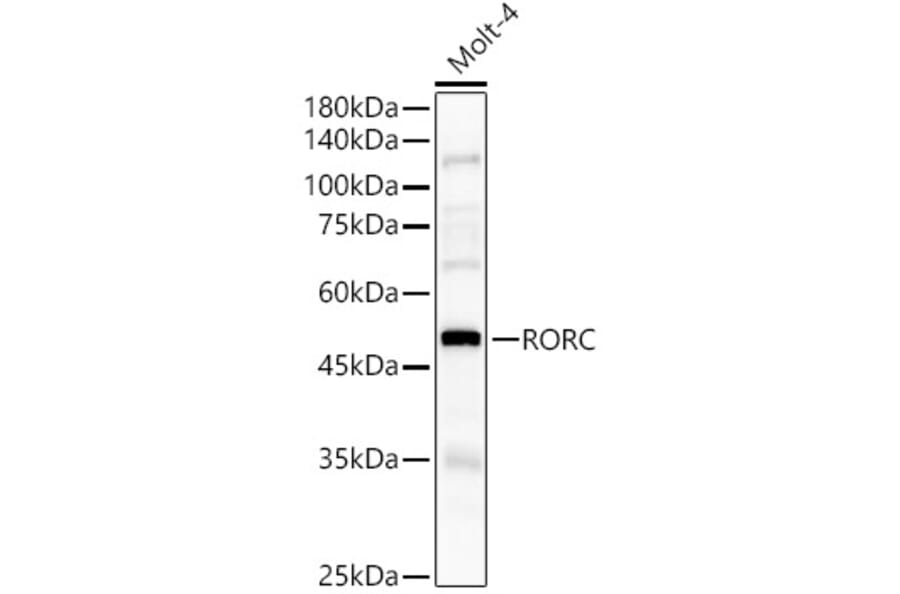 Western Blot - Anti-ROR gamma Antibody (A8559) - Antibodies.com