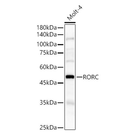 Western Blot - Anti-ROR gamma Antibody (A8559) - Antibodies.com