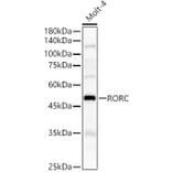 Western Blot - Anti-ROR gamma Antibody (A8559) - Antibodies.com