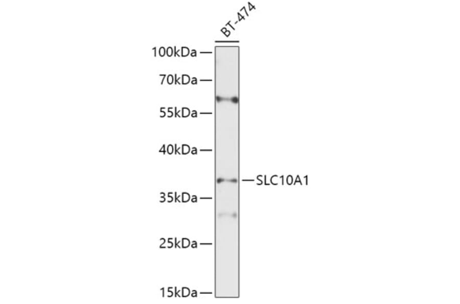 Western Blot - Anti-SLC10A1 / NTCP1 Antibody (A8560) - Antibodies.com